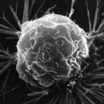 Chinese researchers develop light-based sensor to detect early signs of cancer