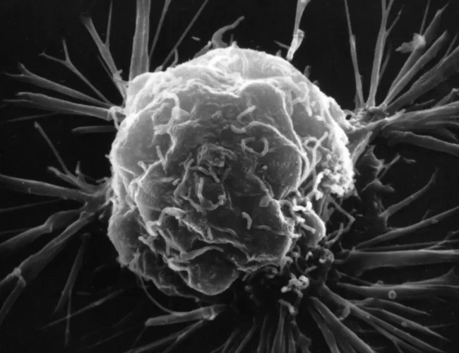 Chinese researchers develop light-based sensor to detect early signs of cancer